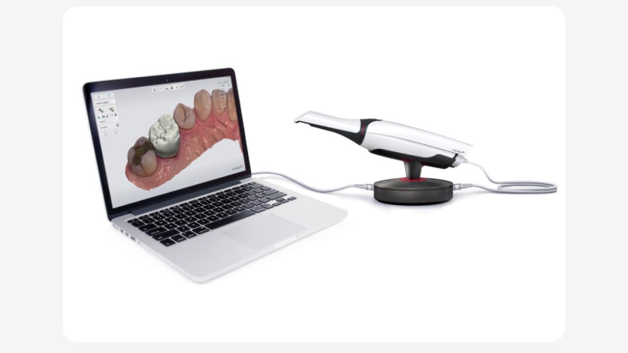 3Shape intraoral scanner beside a laptop displaying a detailed 3D dental model